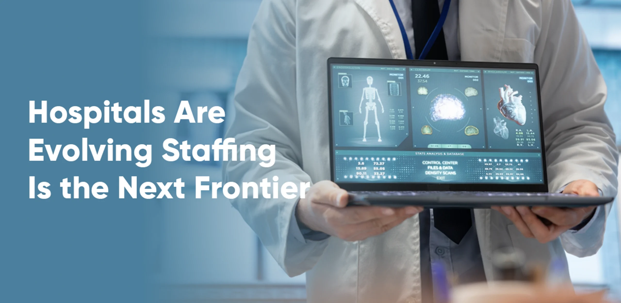 hospital staffing automation in healthcare